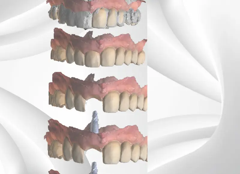 cursos_dent3d-22