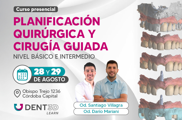 Planificación Quirúrgica y Cirugía guiada- CIRUGÍAS