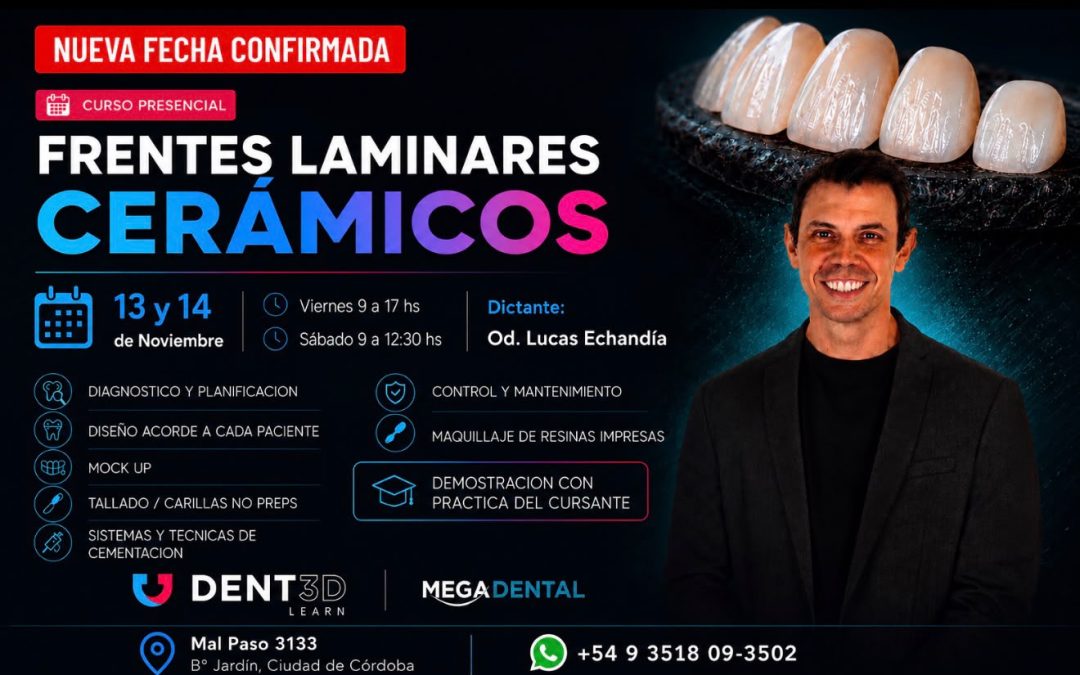 Frentes Laminares Cerámicos