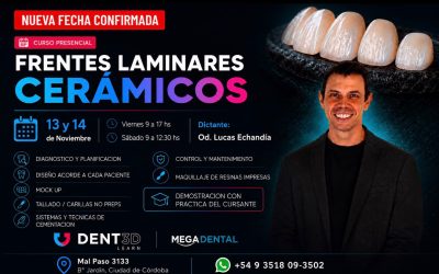 Frentes Laminares Cerámicos